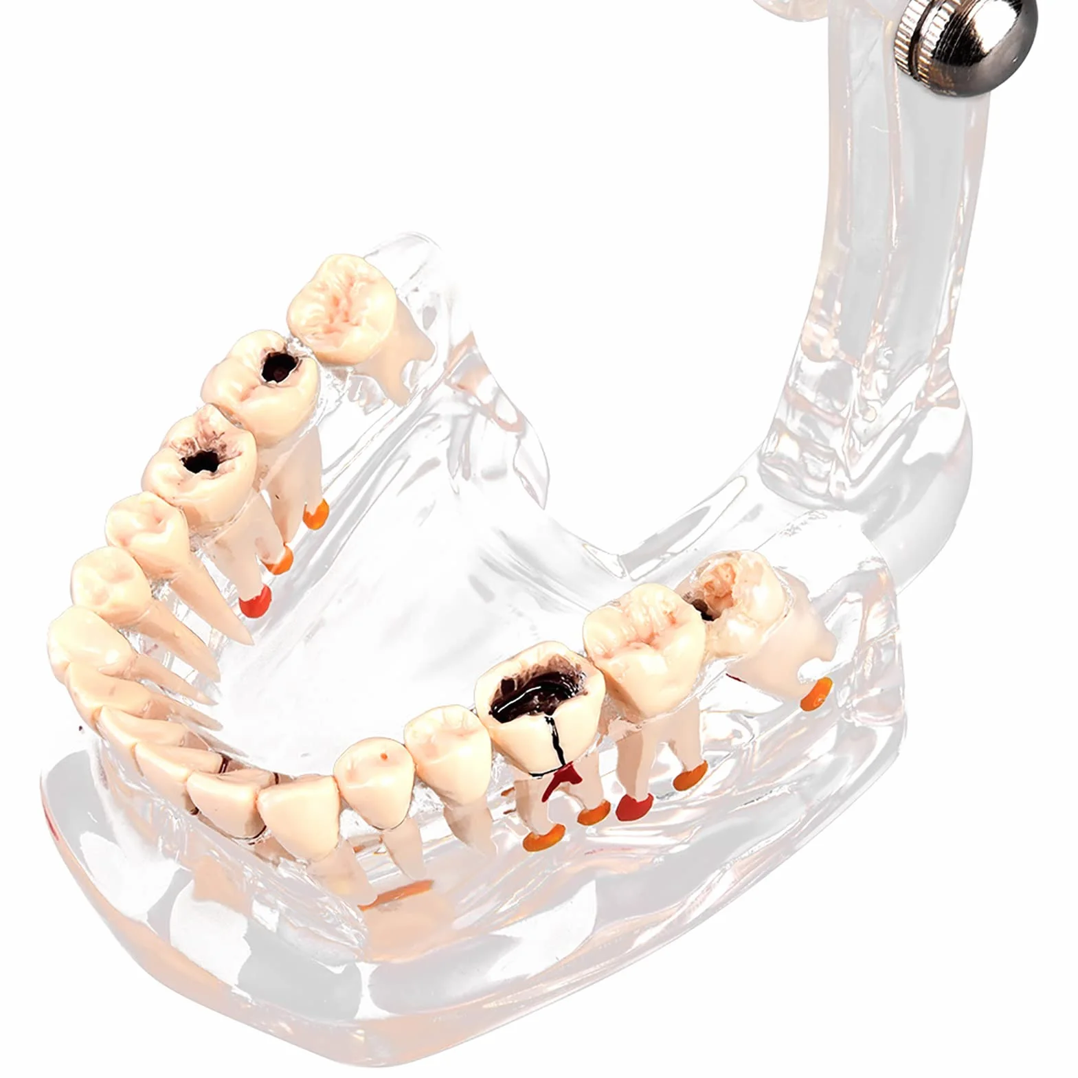 Modelo de Dientes Estándar para Estudiantes de Odontología, Herramienta Educativa Transparente