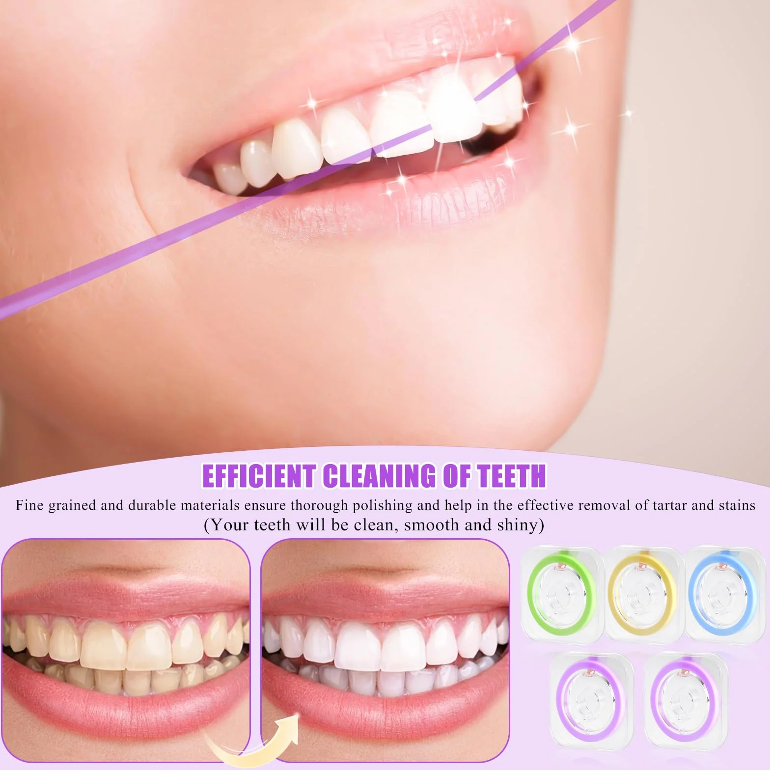 Papel de lija dental 4 mm x 6 m tiras finas 12/20/30/50 μm para espacios intermedios