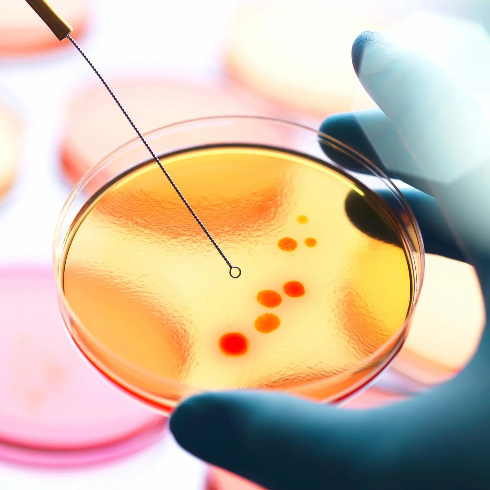 Placas de Petri con Agar Prevertido, Material de Cultivo Microbiológico, Crecimiento Rápido para Laboratorio