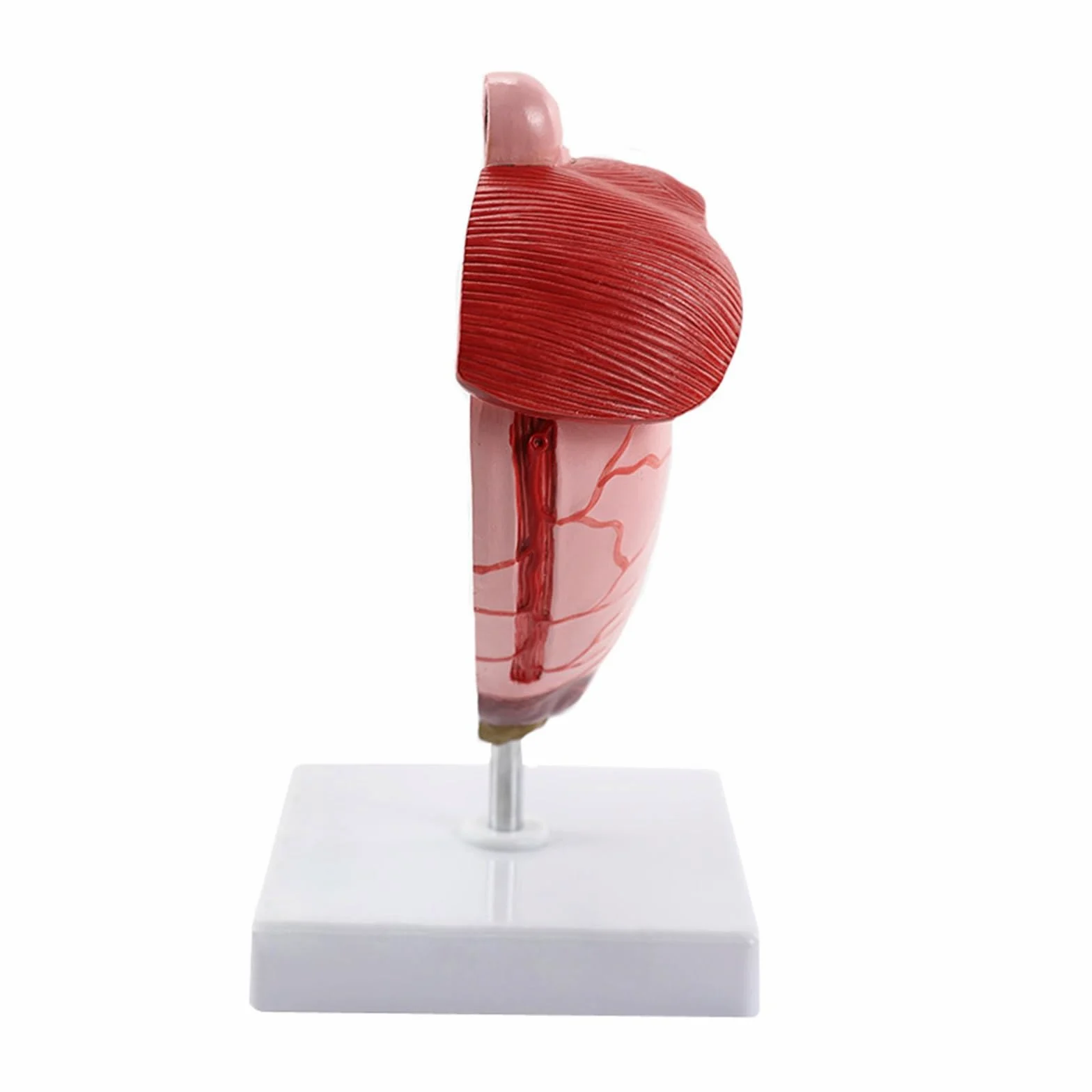 Humano EN Anatomía estomacal patológica Modelo de demostración del estómago Ayuda médica SIDA