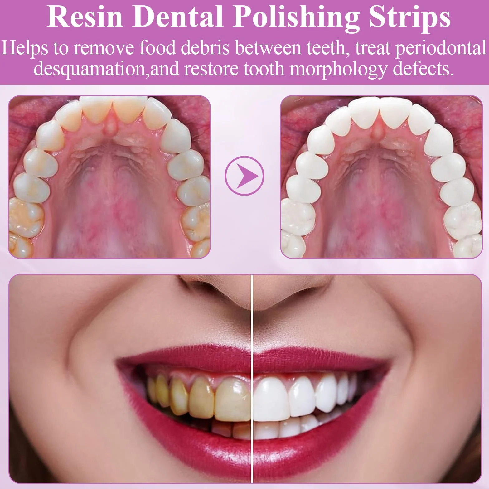 Papel de lija dental 3 volúmenes tiras para pulir dientes azul amarillo púrpura