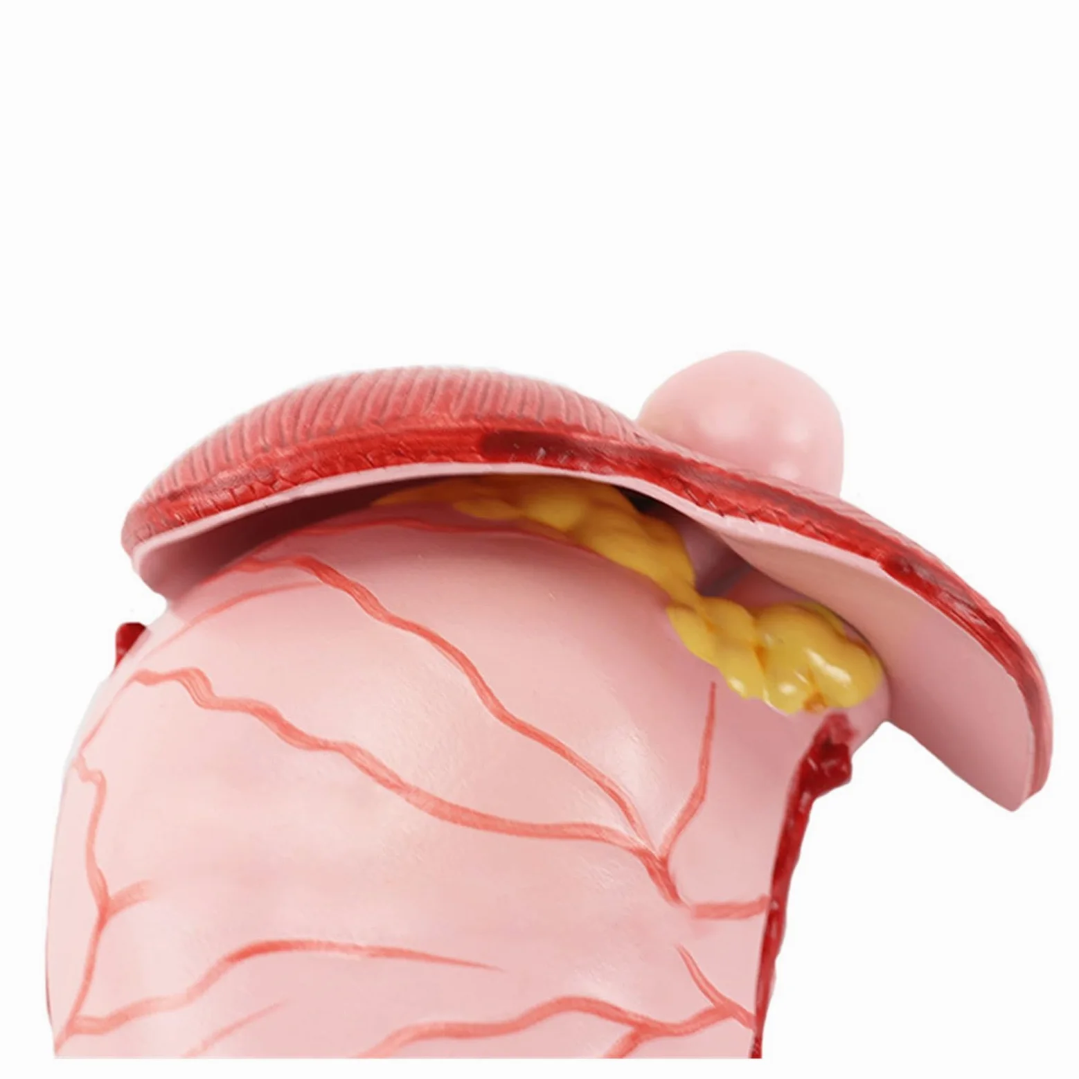 Humano EN Anatomía estomacal patológica Modelo de demostración del estómago Ayuda médica SIDA