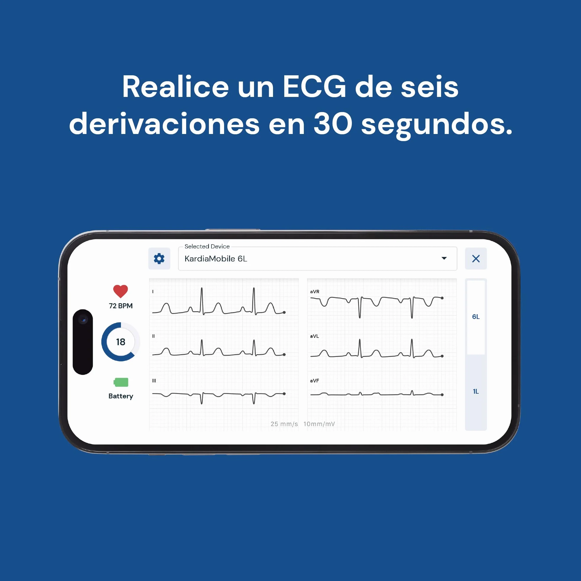 Kardiamobile Electrocardiografo Portatil de 6 derivaciones – Detecta fibrilación Auricular – Resultados instantáneos en 30 Segundos – Funciona con la mayoría de los Smartphones