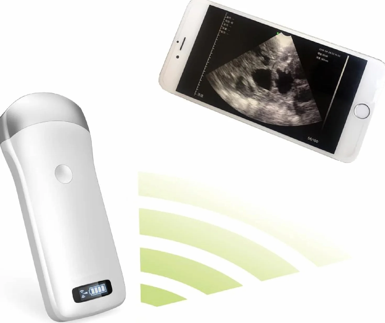 Escáner de ultrasonido inalámbrico portátil, sonda de instrumento de diagnóstico de embarazo veterinario, teléfonos inteligentes compatibles, tableta, for cerdos y ovejas (teléfono móvil no incluido)
