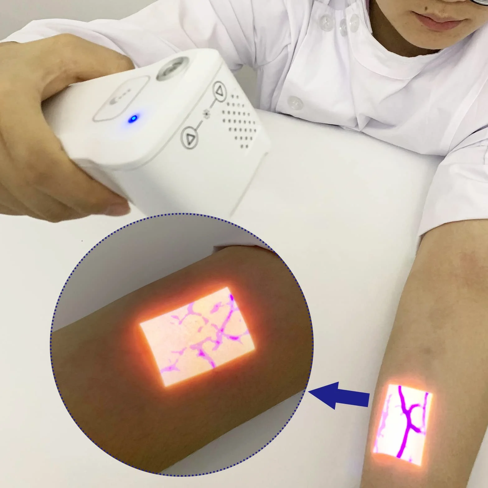 Visor de venas por infrarrojos, localizador de venas médico portátil, luces de visualización de iluminación para enfermeras en Transilluminator, IV soporte de flebotomía