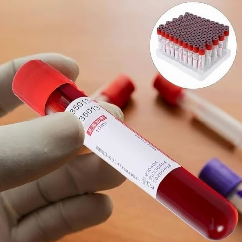 Tubos médicos de extracción de sangre al vacío, paquete de 100, plástico PET para uso en laboratorio, colección de muestras de sangre estériles y seguras