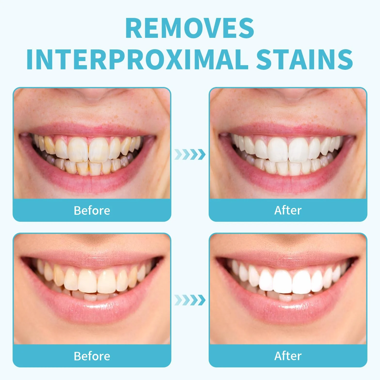 GUTERTOP 60 unidades papel de lija dental tiras de lijado pulido dientes acabado brillante kit