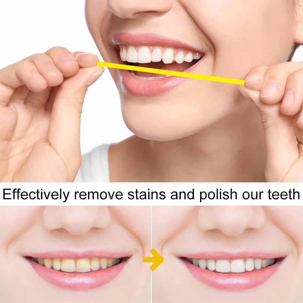 Papel de Lija Dental 20μm Tiras de Pulido Dental para Limpiar Dientes Herramientas de Cuidado Bucal