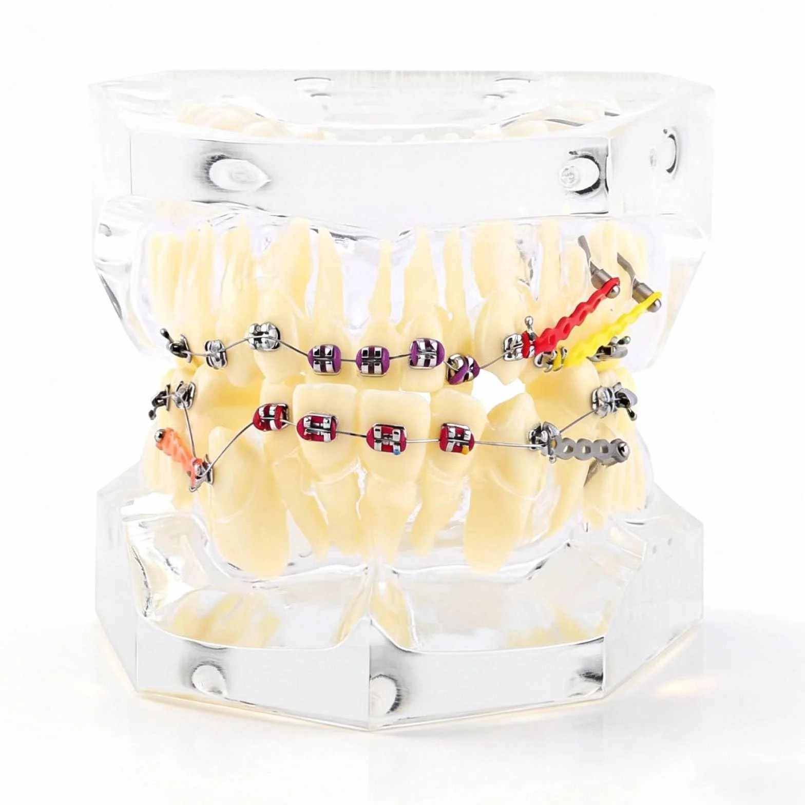 Tipodonto Oral Dental Modelo Dental Ortodóntico Estándar con Dentadura de Resina y Alambre Transparente