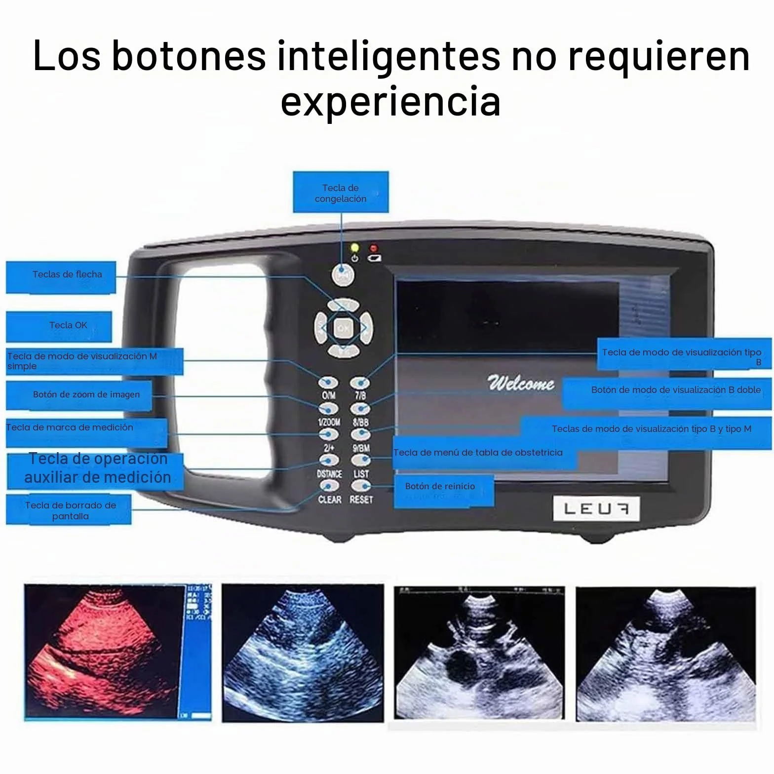 Kit de escáner de ultrasonido veterinario, máquina portátil de pruebas de embarazo HD con sonda mecánica para cerdos y ovejas, ideal para pruebas de embarazo en animales
