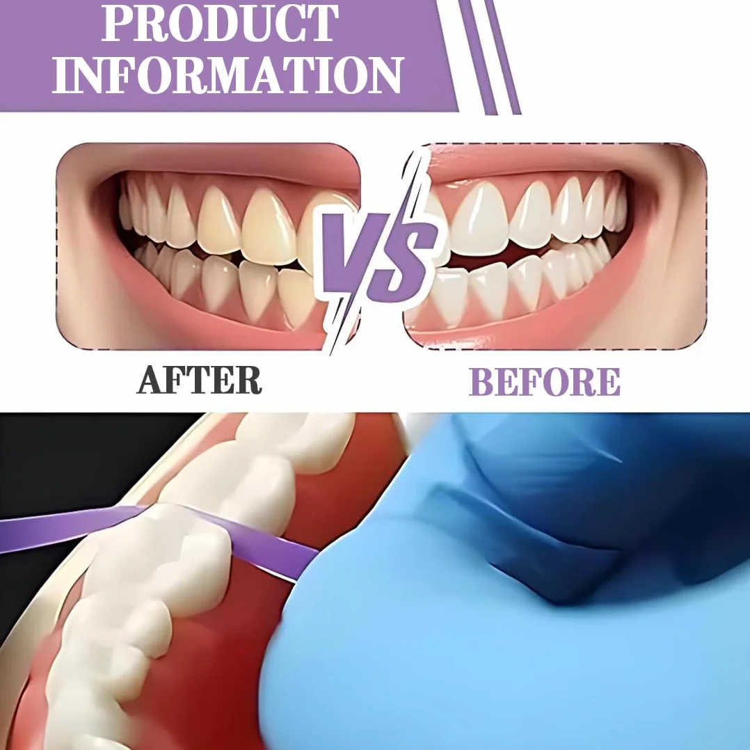 Tiras de Pulido Dental Papel de Lija 20μm 50μm 2 Volúmenes