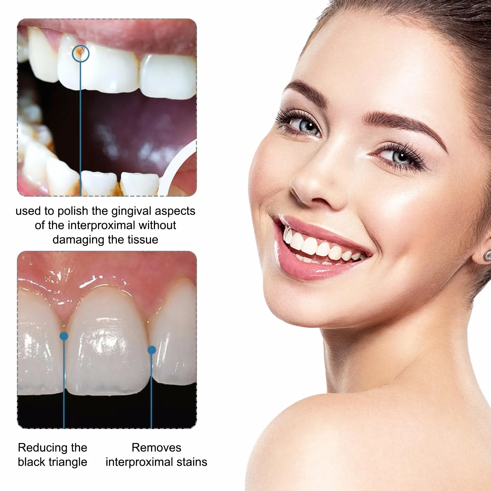 Papel De Lija Dental 2 Pcs Tiras De Lijado Abrasivos Dientes