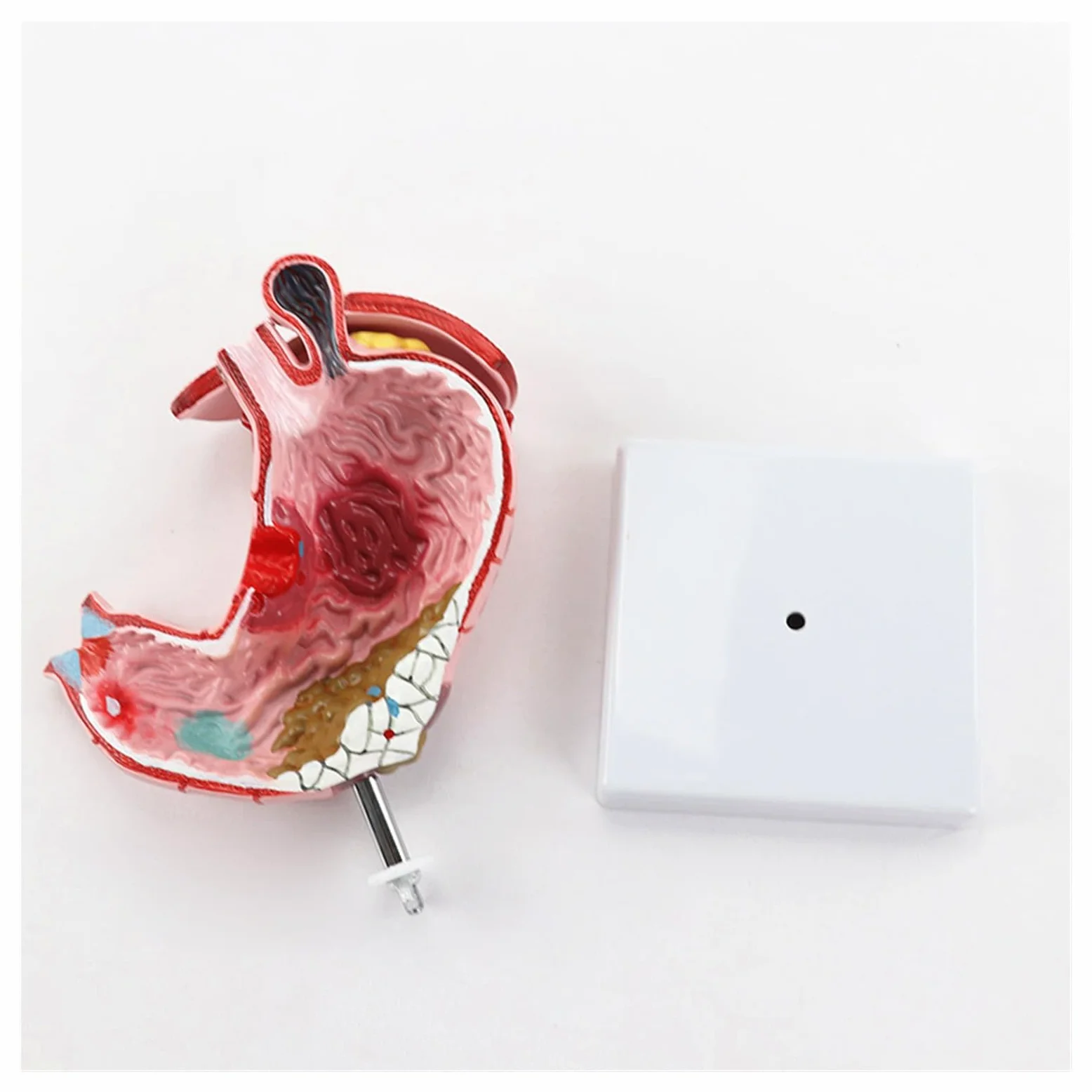 Humano EN Anatomía estomacal patológica Modelo de demostración del estómago Ayuda médica SIDA