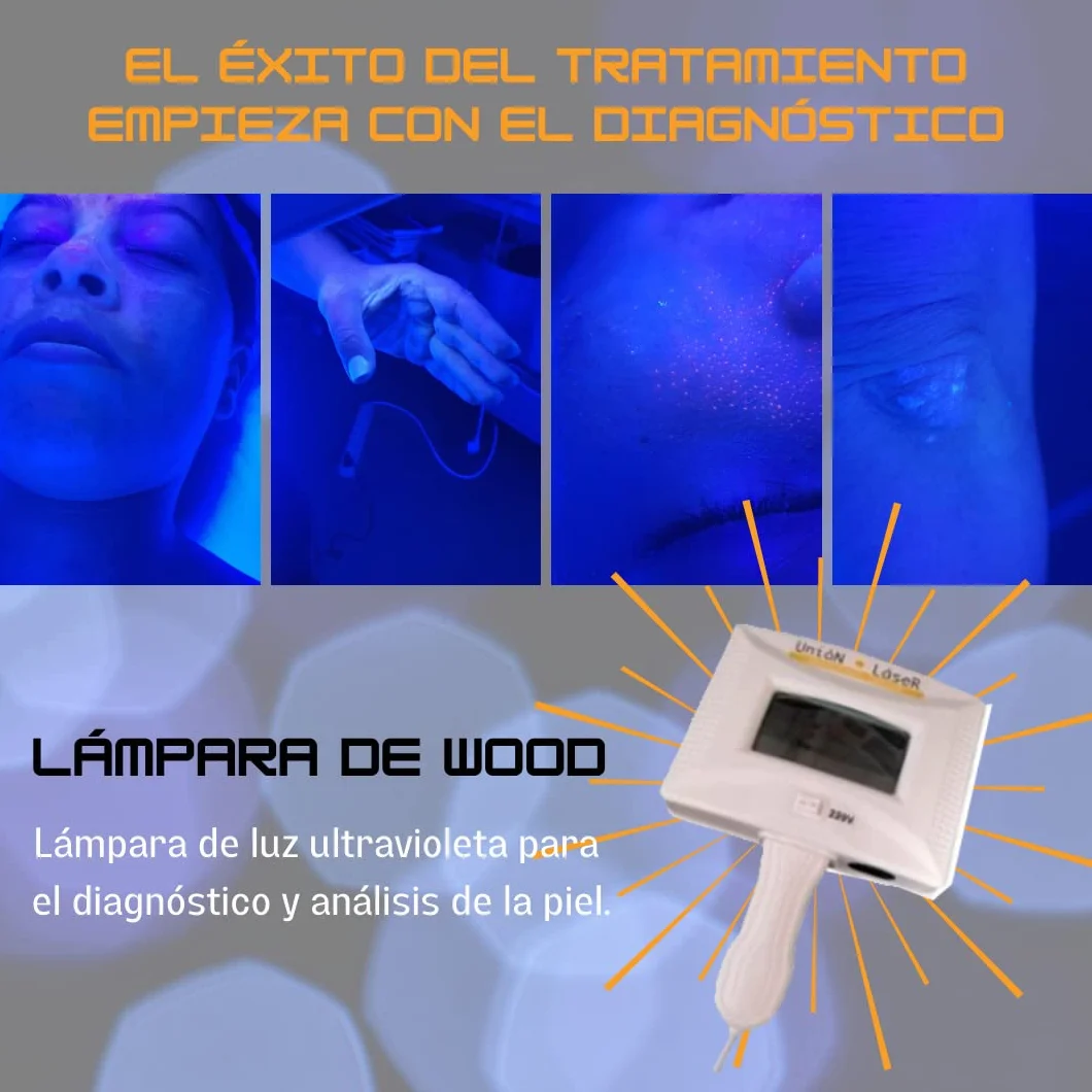Lámpara de Wood para diagnóstico facial