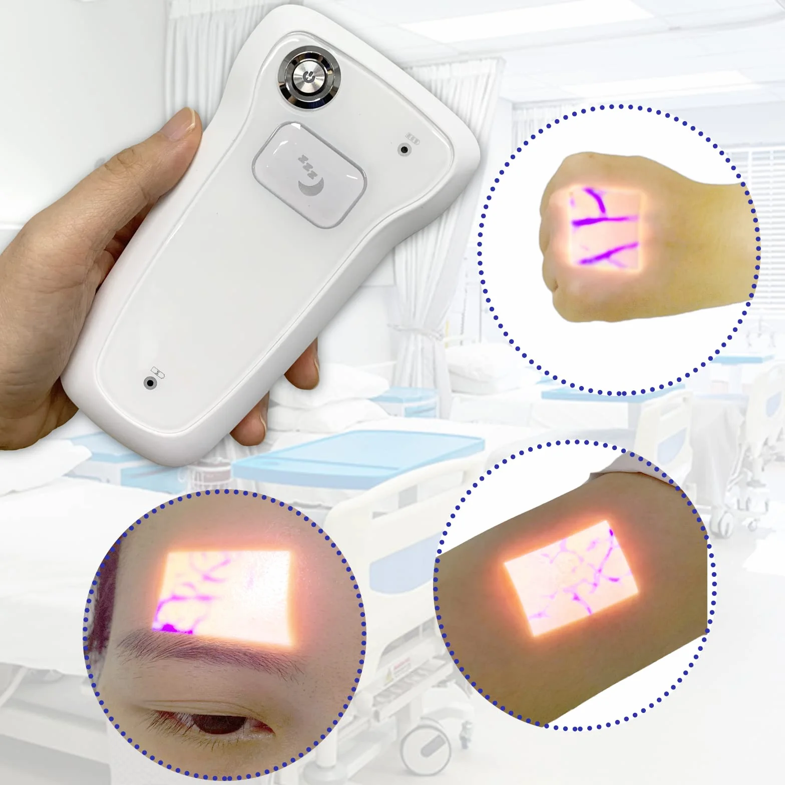 Visor de venas por infrarrojos, localizador de venas médico portátil, luces de visualización de iluminación para enfermeras en Transilluminator, IV soporte de flebotomía