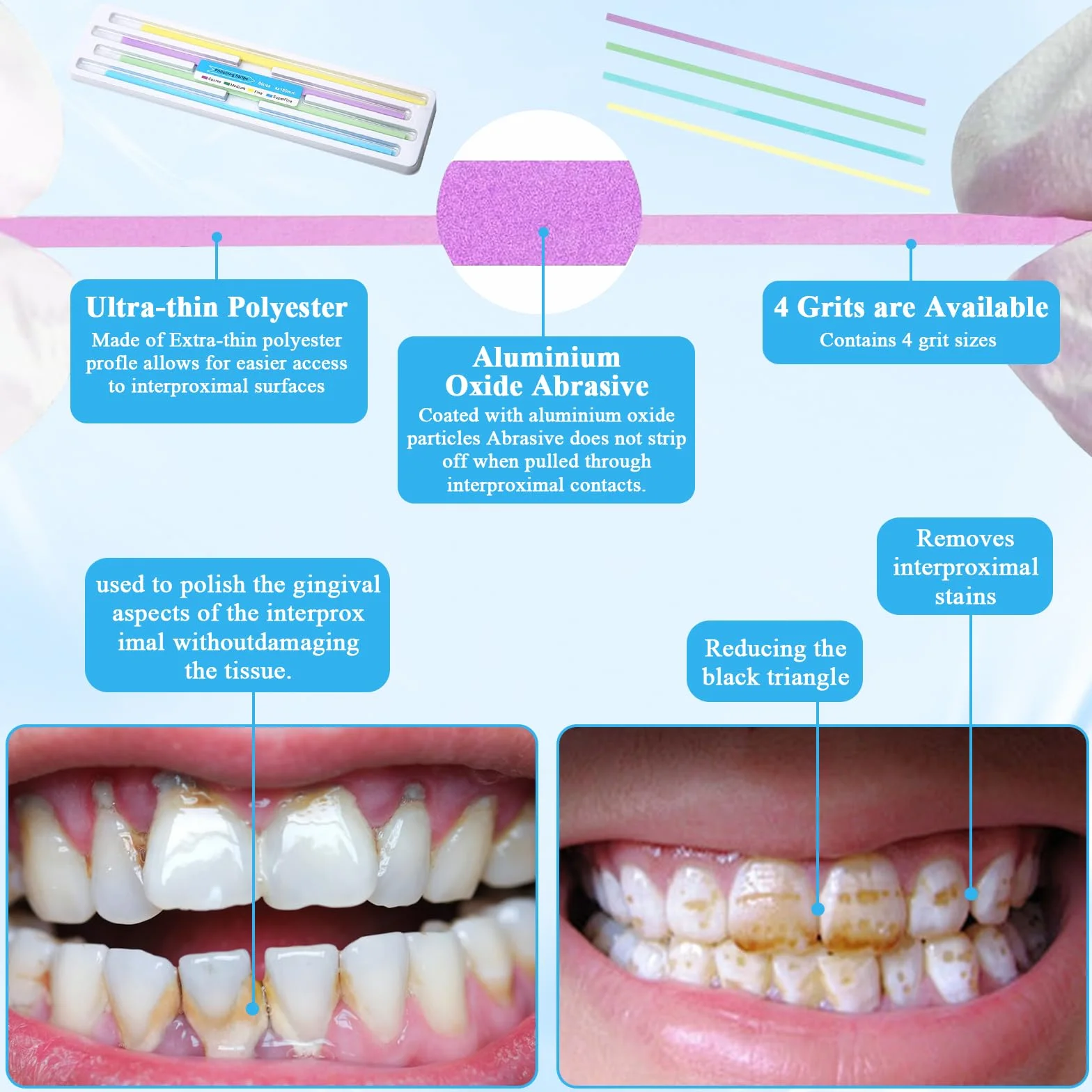 Papel de Lija Dental 4×150 mm 60 Piezas Tiras de Pulido Portátil Eliminación de Sarro Multicolor