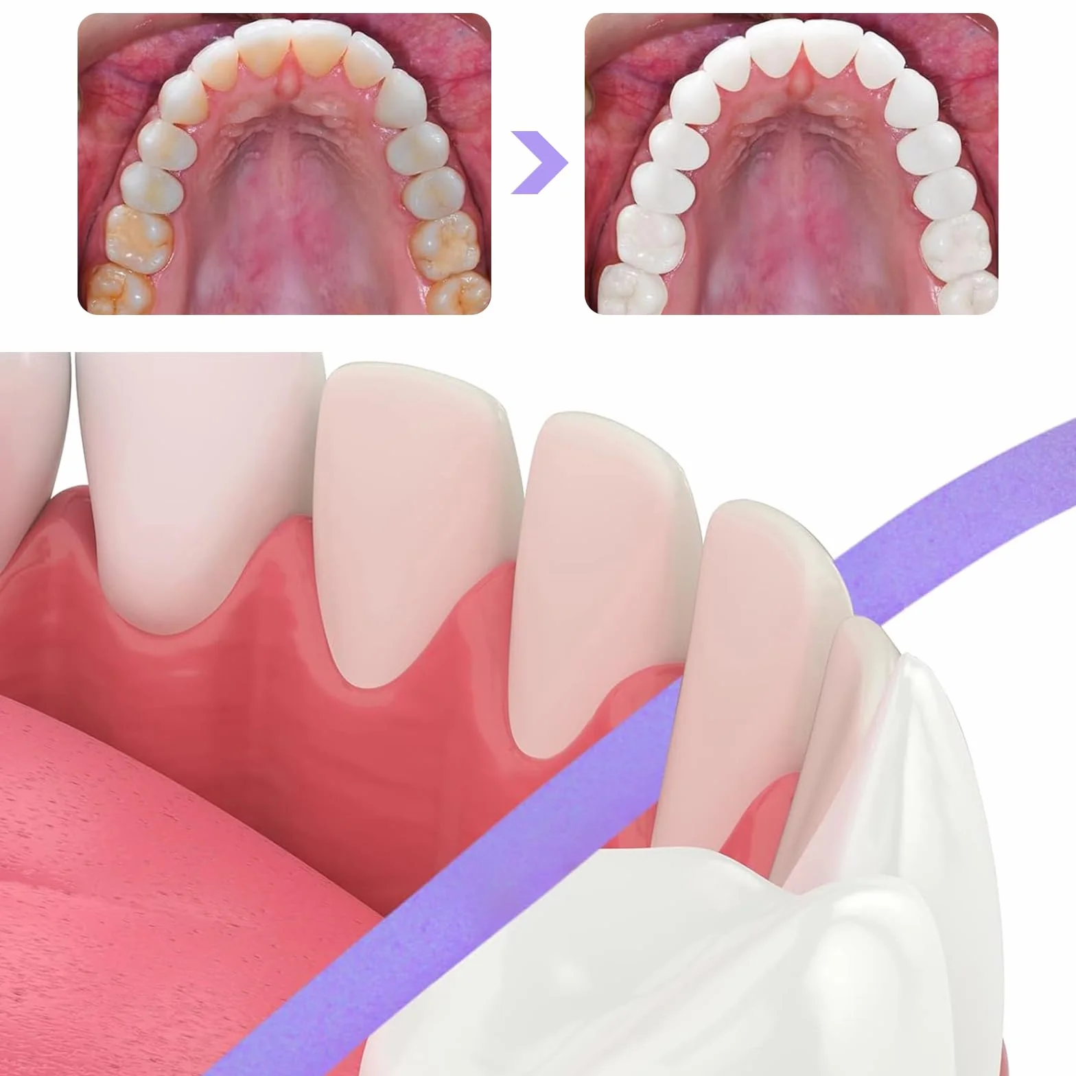 Papel de Lija Dental 3 Rollos Tiras de Pulido Interdental para Limpiar Dientes Cuidado Bucal