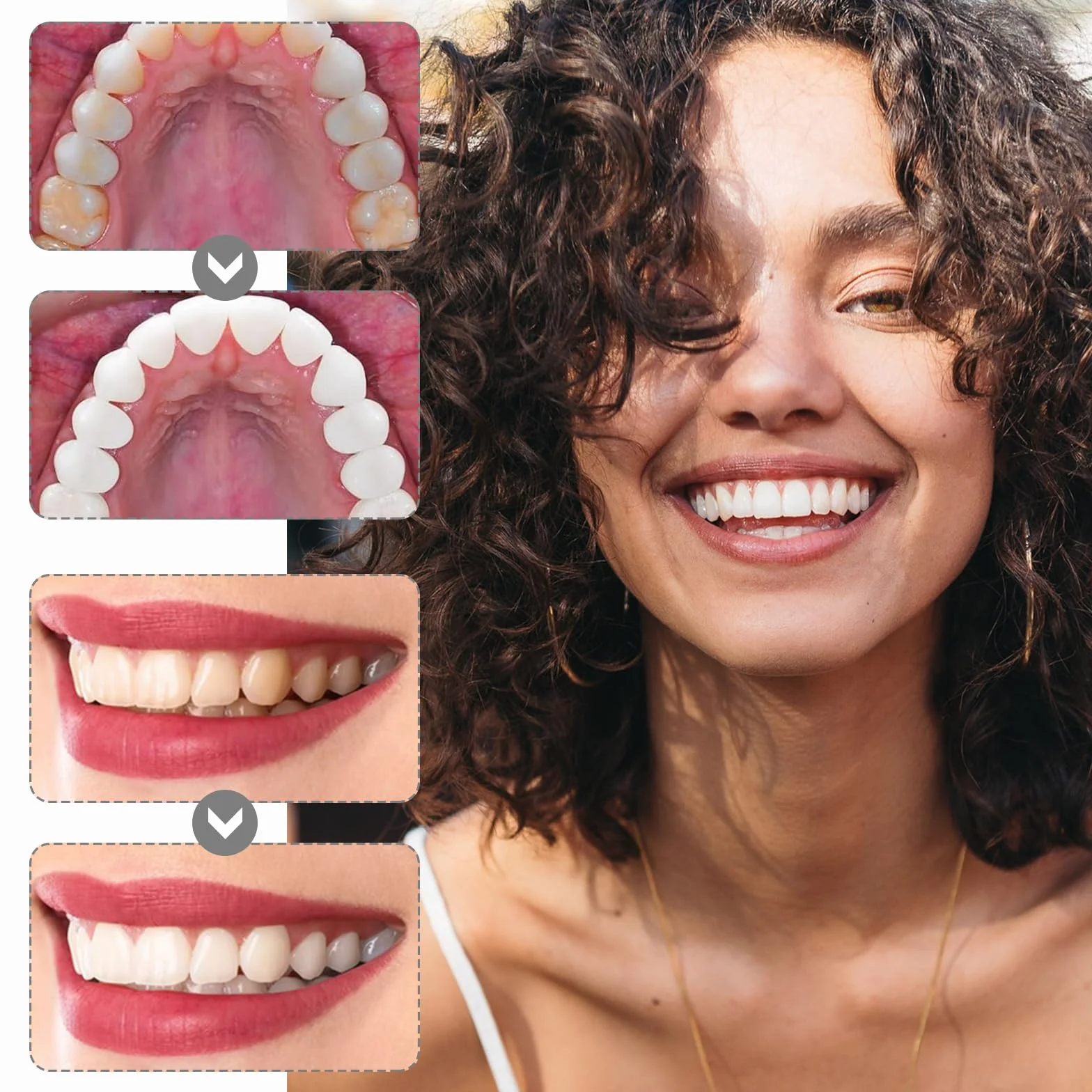 Papel De Lija Dental 2 Pcs Tiras De Lijado Abrasivos Dientes