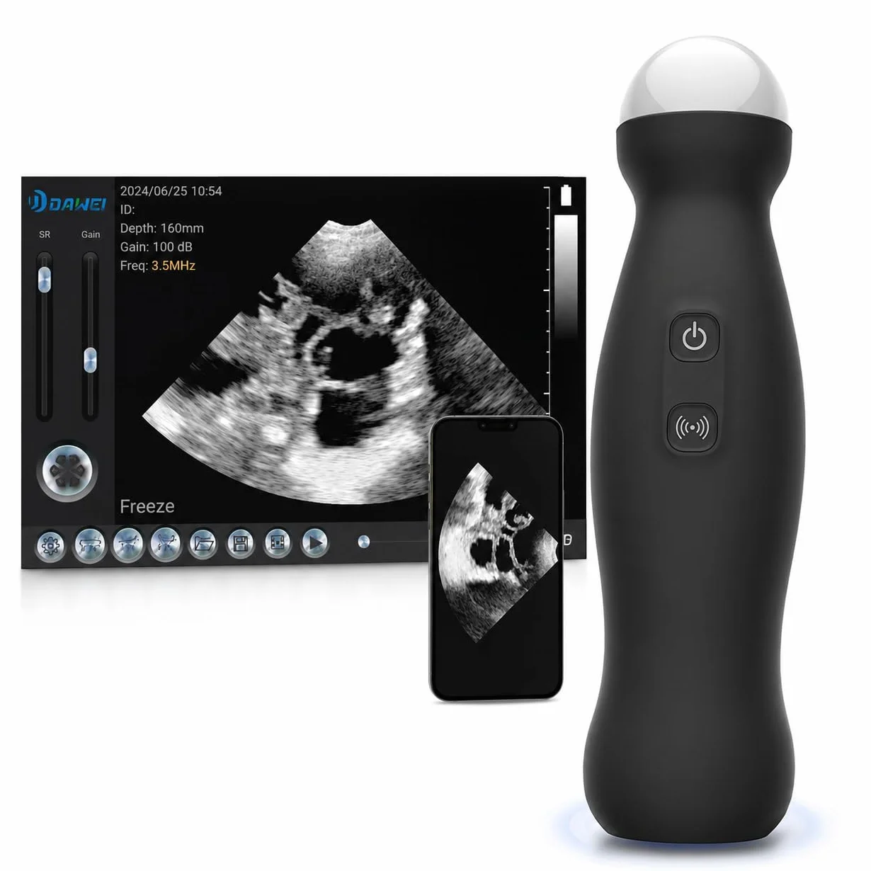 Escáner de ultrasonido veterinario inalámbrico, dispositivo de mano compatible con Android con sonda de 3,5 MHz para detección de embarazo en perros, ovejas y cerdos