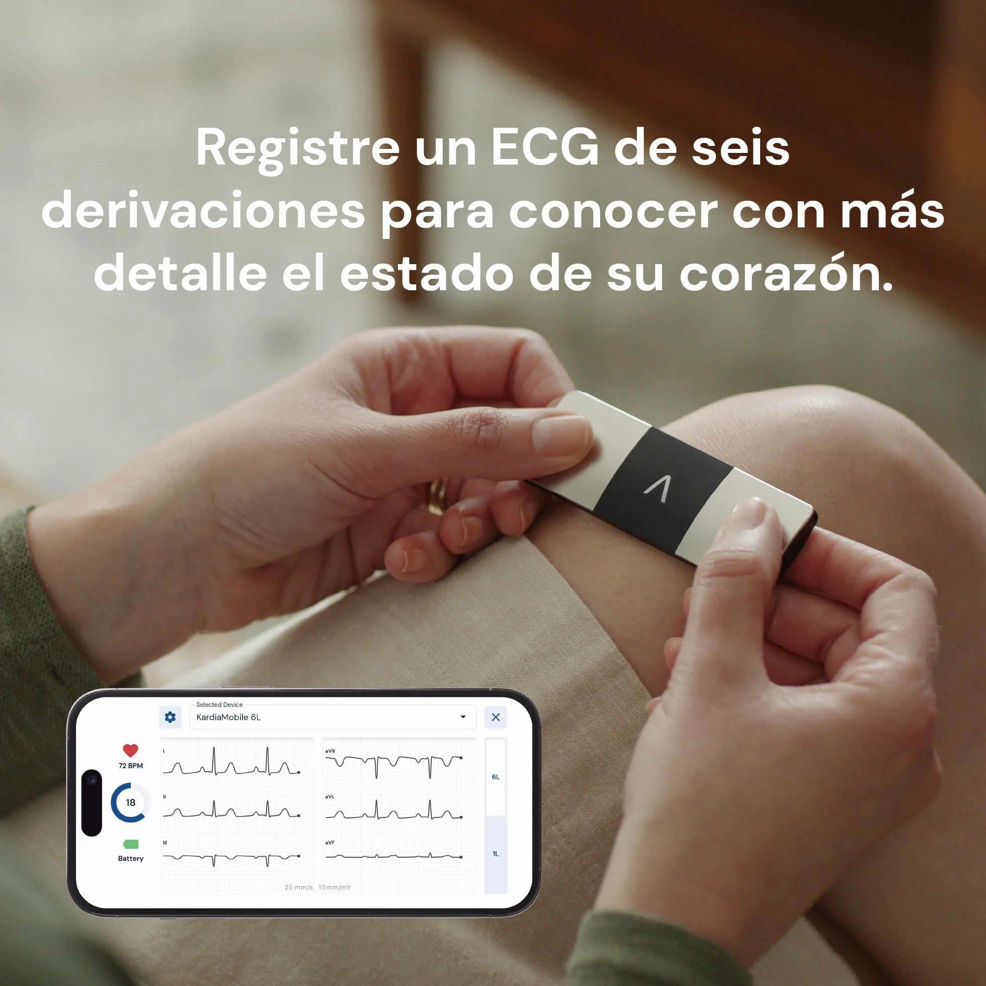 Kardiamobile Electrocardiografo Portatil de 6 derivaciones – Detecta fibrilación Auricular – Resultados instantáneos en 30 Segundos – Funciona con la mayoría de los Smartphones