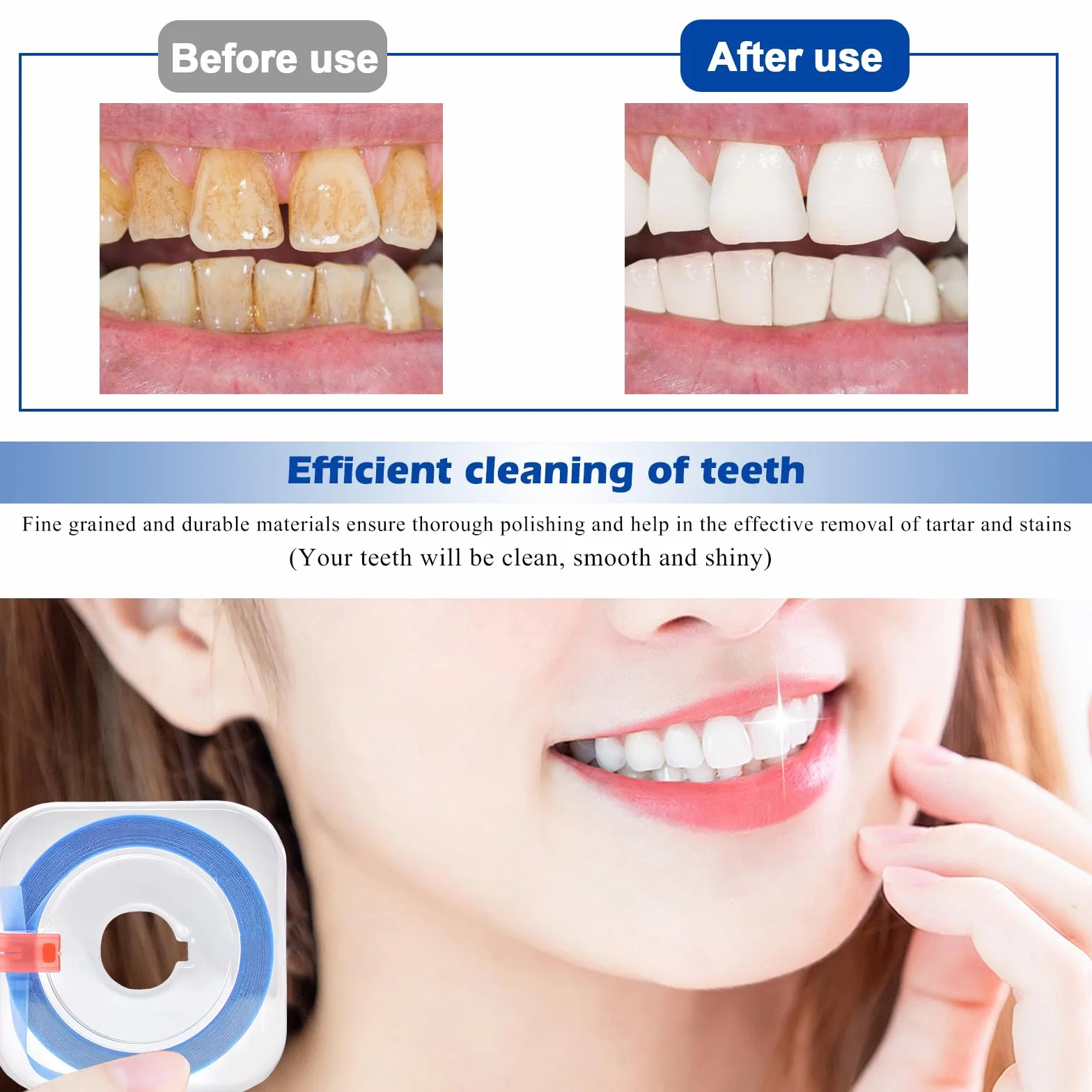 Juego de 4 rollos de papel de lija dental: tiras de pulido dentales portátiles, herramientas de lijado interdental para pulir dientes