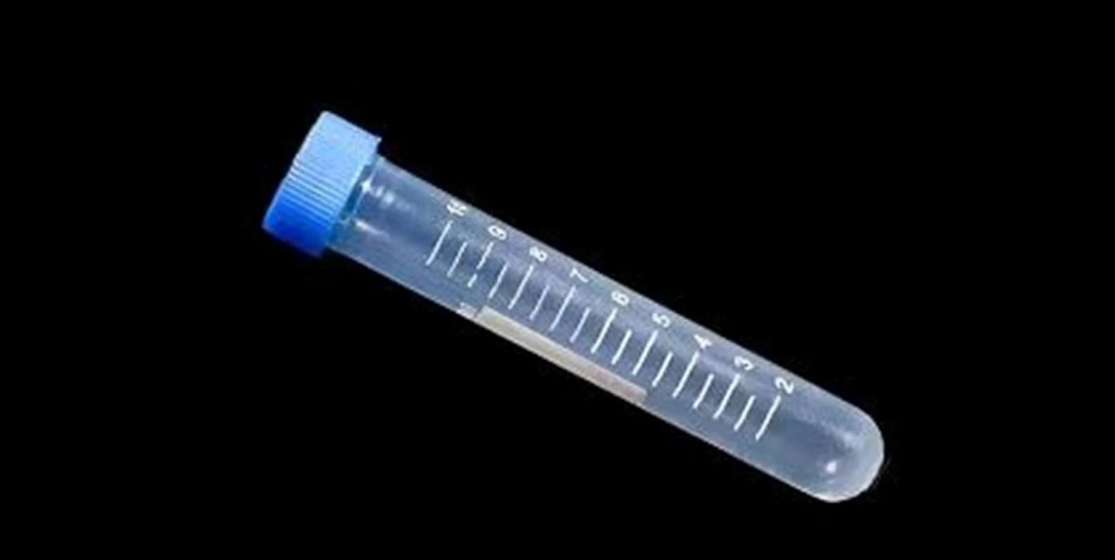 100 unids/Pack 10mL Tubo de centrífuga de plástico de Laboratorio tapón de Rosca Tubo de ensayo centrífugo de Laboratorio
