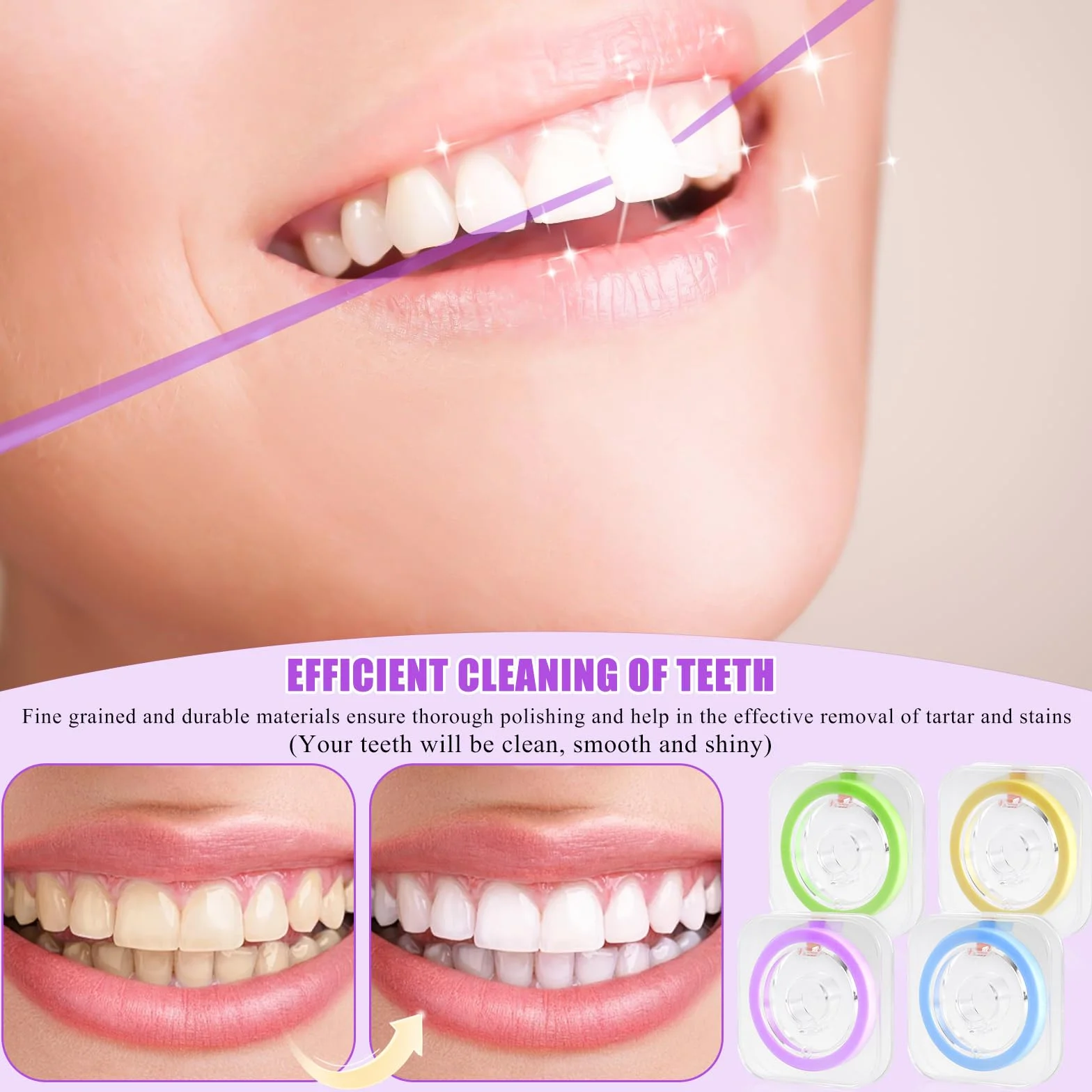 Papel de lija dental 4 volúmenes, tiras de pulido, cinta interdental 6m