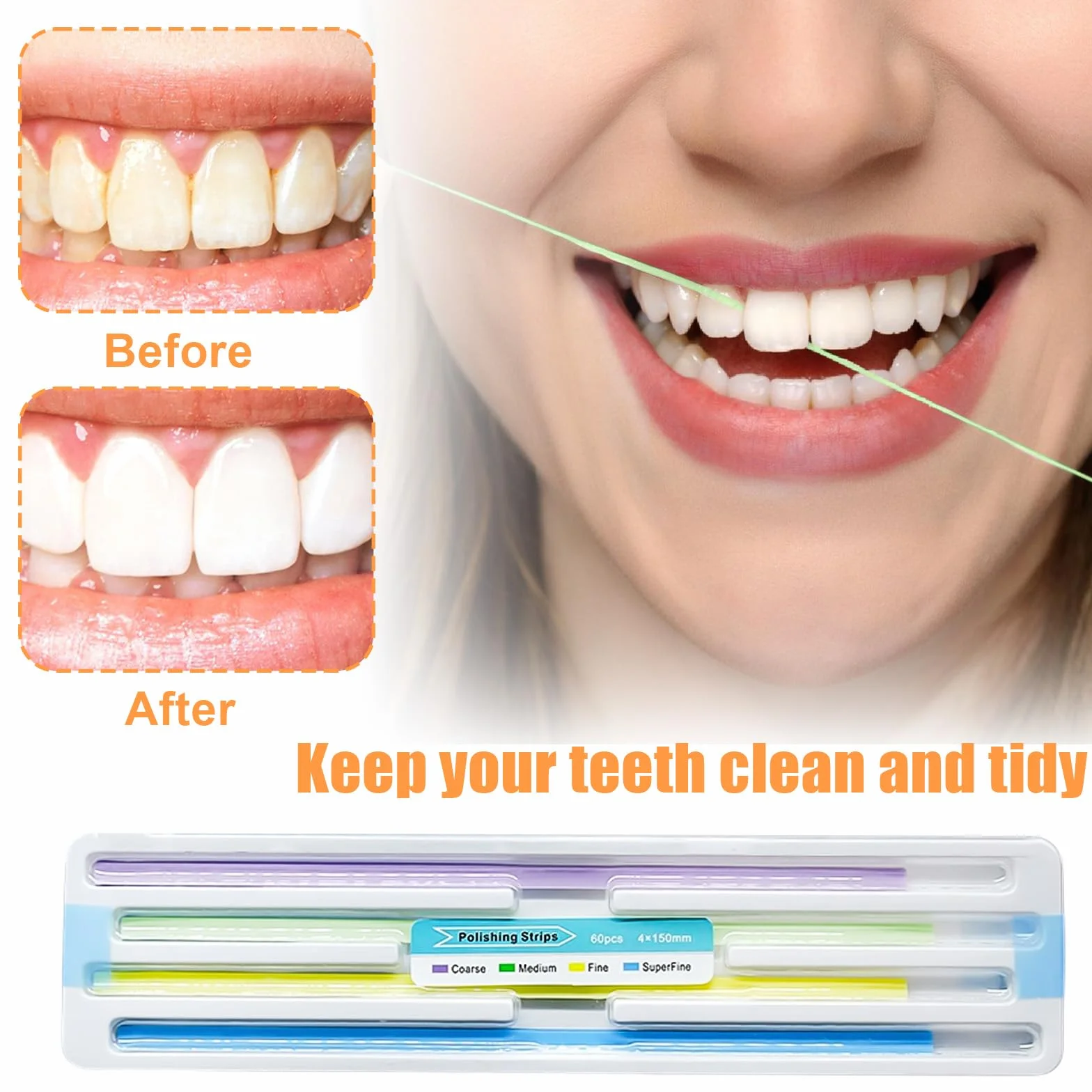 Tiras Abrasivas Dentales 180 Piezas Multifuncionales 150 mm Coloridas
