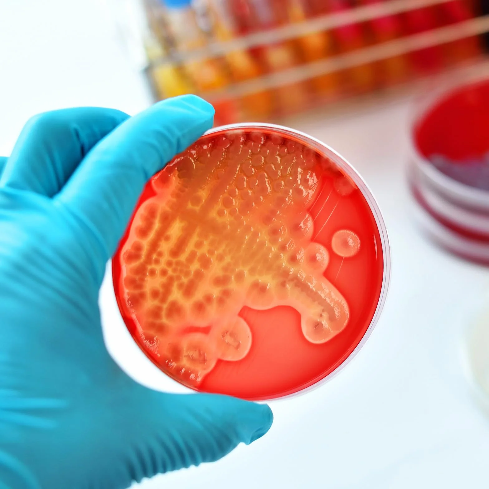 Placas de Petri con Agar Prevertido, Material de Cultivo Microbiológico, Crecimiento Rápido para Laboratorio
