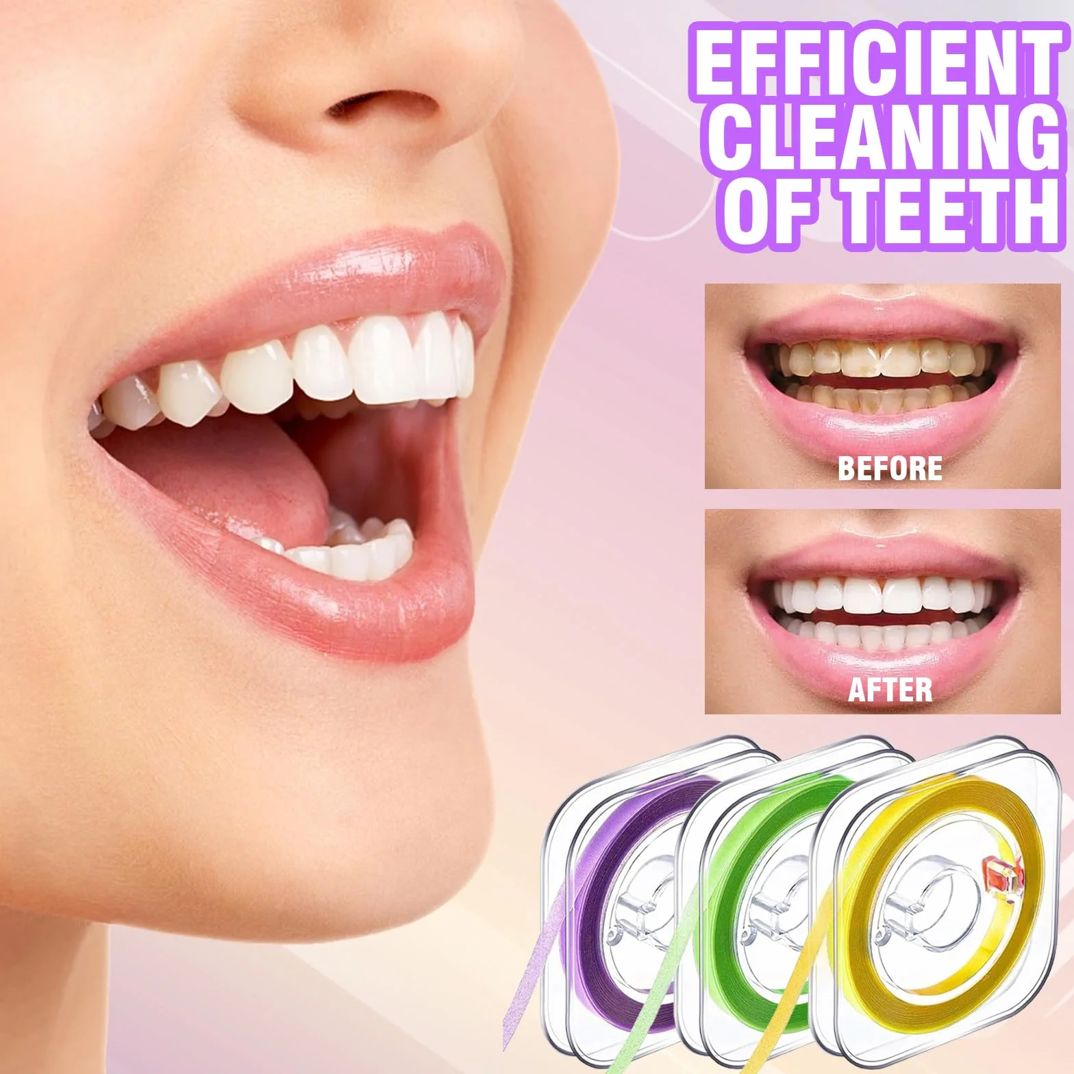 Papel de Lija Interdental 3 Volúmenes Tiras de Lijado Dental 20/30 μm Amarillo/Verde/Morado Cepillo Interdental