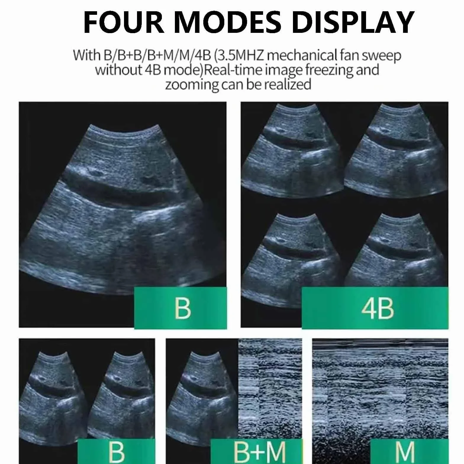 Escáner de Ultrasonido Veterinario, Veterinario Portátil B-Ultra Máquina de Escáner con 6,5 MHz Rectal Sonda 4 Campos de Color para Ganado Vacuno,Equino,Camello Prueba de Embarazo