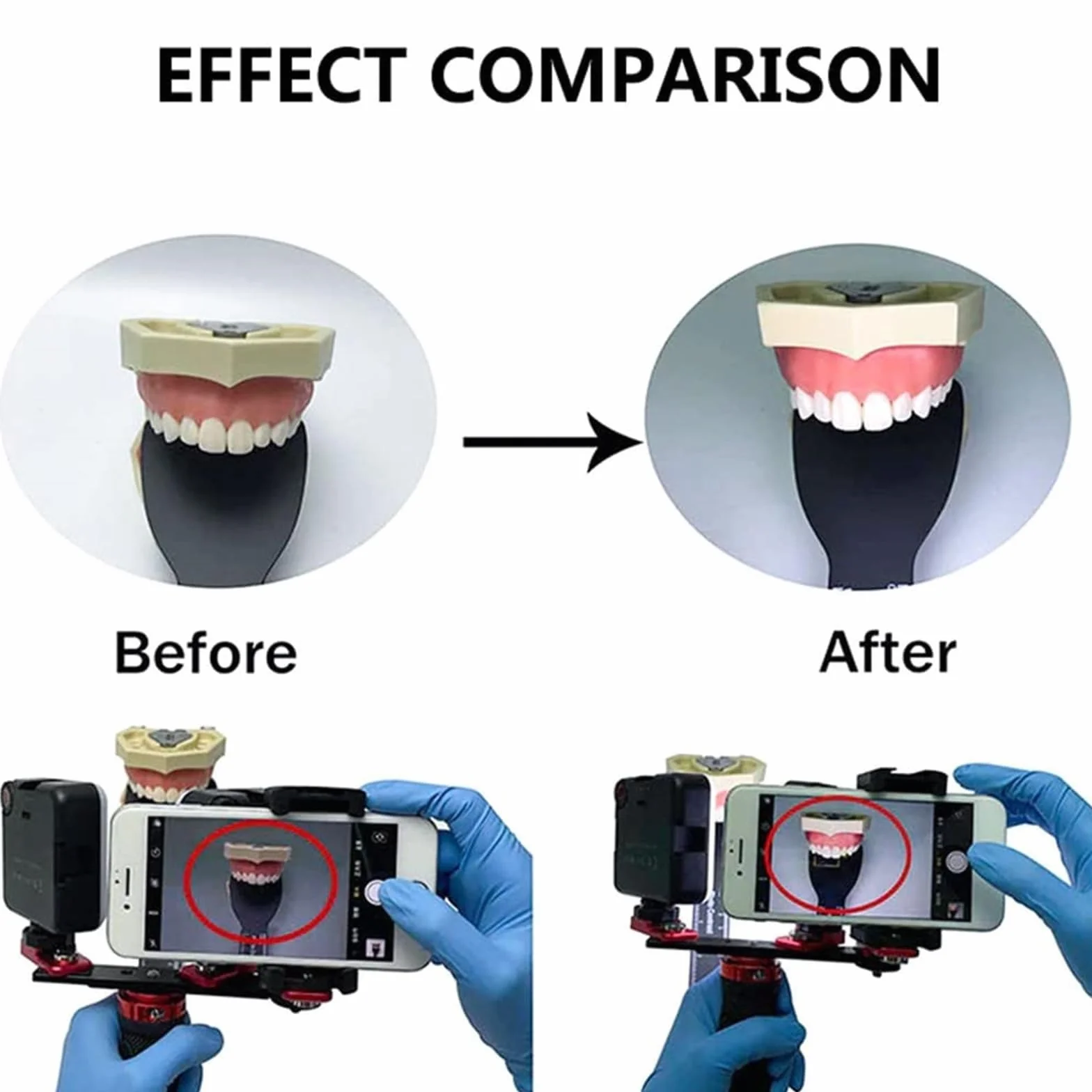 Kit de Iluminación Dental LED 360° Ajustable para Fotografía con Cámara de Teléfono Móvil